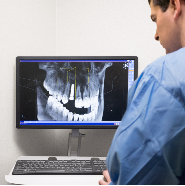 картинка Фотополимерная смола Formlabs Dental SG Resin Интернет-магазин «3DTool»